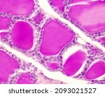 Small photo of Rabbit thyroid gland. PAS method. Due to the glycoprotein nature of thyroglobulin, the thyroid colloid is intensely PAS +. Surrounding the colloid, thyrocytes are forming a simple cuboidal epithelium