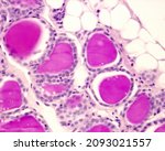 Small photo of Rabbit thyroid gland. PAS method. Due to the glycoprotein nature of thyroglobulin, the thyroid colloid is intensely PAS +. Surrounding the colloid, thyrocytes are forming a simple cuboidal epithelium.