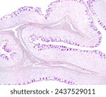 Small photo of Gastric wall mucosa showing many folds with an axis of submucosa. In the mucosa, the mucous surface epithelium and foveolar cells of gastric pits show a great PAS positivity. PAS method.