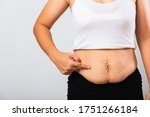 Close up of Asian mother woman pointing stretch mark loose lower abdomen skin she fat body after pregnancy baby birth, studio isolated on white background, Healthy belly overweight excess body concept