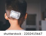 Small photo of The lacerated suture wound of kid back head which suture with trauma the head by medical bandage, Medical care of the surgery lesion on the head, children of Accident