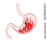 stomach fire. excessive acidity ... | Shutterstock .eps vector #2078965927