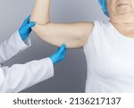 Small photo of Brachioplasty. Plastic arms, dangling skin at the elbow. An older woman shows the surgeon problem areas of the forearm. Examination before cosmetic surgery