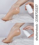 Small photo of Cracked heels. Woman feet before and after procedures to soften rough skin. Urea cream, oil for care of keratinized skin, healing of cracked foot. Usage foot grater, cream with urea, softening oil.