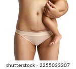 Small photo of Woman belly with a scar from a cesarean section with her baby's legs on white background