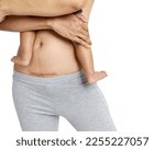 Small photo of Woman belly with a scar from a cesarean section with her baby's legs on white background