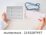 Small photo of Close up cardiologist holding the latest electrocardiogram of a patient with heart disease arrhythmia myocardial infarction an compare with old one on a tablet.
