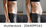 Small photo of Before and after young woman side view of body. Swollen belly. Pregnancy. Diastasis recti after child birth. Fitness exercises and diet for weight loss.