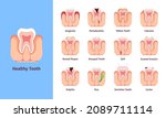 teeth problems. medical... | Shutterstock .eps vector #2089711114