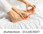 Small photo of Side view of female hands scratch legs sitting on white bed at home. Itchy skin, fungus, fungal bacterial infection, allergic reaction, eczema, dermatitis of the foot. Health and skincare concept.
