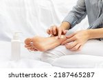 Small photo of Hands of an unrecognizable woman applies moisturizing nourishing cream to the heels of feet with dry cracked skin while sitting on bed. Home foot care and treatment for dermatitis, eczema, dryness.