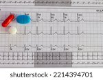 Small photo of Electrocardiogram showing a supraventricular tachycardia and colored pills. Medical desk concept or flat lay.