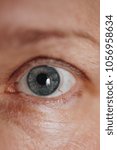 Small photo of closeup of the eye. eye close up. inflamed vessels on the eyes. eye allergy. Acanthamoebic keratitis. Blepharitis. Asthenopia. the eye of an elderly person. blue eyes