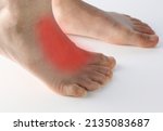 Small photo of Close up human foot with red area to point of pain on top of foot on extensor tendonitis caused by tight shoe, flat feet, prolong standing , muscle tightness in children isolated on white background.