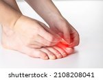 Small photo of A woman glues a plaster for the treatment of calluses and calluses to her toe. Close-up