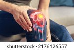 Small photo of VFX Joint and Knee Pain Augmented Reality Render. Close Up of a Person Experiencing Discomfort in a Result of Leg Trauma or Arthritis. Massaging the Muscles to Ease the Injury.