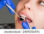 Small photo of Taking care of teeth. Woman at the dentist. Dental care, taking care of teeth. Girl having teeth examined at dentists. Woman in stomatology clinic with dentist. Healthy teeth concept.