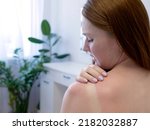 Small photo of Red hair woman strokes and scratches sunburn skin on back and shoulders. Close-up view of back and shoulders with sunburn marks. Woman with reddened itchy skin. Concept of sunbathe without sunscreen.