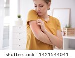 Woman scratching arm indoors, space for text. Allergy symptoms