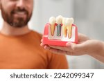 Small photo of Doctor with educational model of dental implant consulting patient in clinic, closeup