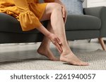 Small photo of Barefoot woman with varicose veins on sofa in room, closeup