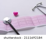 Small photo of ECG diagram paper phonendoscope medical examination background. Cardiogram of young adult Prevent disease, mitral valve prolapse or click-murmur syndrome. Analyze graph people heart rate measurements.