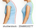 Small photo of A young woman stands bent and straightened isolated on a white background. Correct and incorrect spine position. Slouching back and healthy spine. A posture before and after changing. Scoliosis