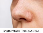 Close-up of a woman's nose with blackheads or black dots isolated on a white background. Acne problem, comedones. Enlarged pores on the face. Cosmetology dermatology concept