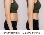 Small photo of Two shots of a woman in profile with a belly with excess fat and toned slim stomach with abs before and after losing weight isolated on a beige background. Result of diet, liposuction, training