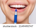 Small photo of Cropped shot of a young woman pointing to white spot on the tooth enamel with a pen. Oral hygiene, dental health care. Dentistry, demineralization of teeth, enamel hypoplasia, pathology, fluorosis