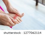 Painful And Inflamed Gout On...