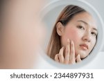 Small photo of Woman worried about face Dermatology, rosacea dermatitis, allergic steroids, sensitive skin, red face from sunburn, acne, dry skin, large pores ,rash face, dull, freckles, wrinkle, skin problem