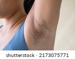 Small photo of Woman holding her arms up and showing armpit hair.Unshaven armpit hair. Problem skin under the armpit. Healthcare and skincare concept.