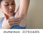 Small photo of Woman showing her arms up and showing armpit hair.Unshaven armpit hair. Problem skin under the armpit. Healthcare and skincare concept.