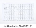 Small photo of ECG with rhythm disturbance, rapid atrial flutter with myocardial ischemia on a white background. Top view. Pathological heart disease