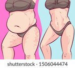 belly fat  before after. vector ...