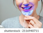Small photo of A young woman is engaged in home teeth whitening. Complex for teeth whitening with UV lamp