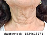 Aging skin folds or skin creases or wrinkles at neck of Southeast Asian, Chinese elderly woman. Front view.