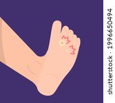 illustration of a foot affected ... | Shutterstock .eps vector #1996650494