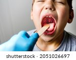 Small photo of The boy's mouth is wide open with tonsils are enlarged, visible in the white or yellowish tinge on a gray background. Pediatrician checking 8-aged schoolboy's throat applying wooden spatula.