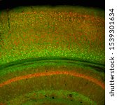 Small photo of Cerebral cortex and part of the hippocampus under it in a section of a mouse brain, labelled with immunofluorescence and recorded with confocal laser scanning microscopy