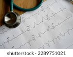 Small photo of stethoscope on a real emergency ECG with a occlusive anterior myocardial infarction (STEMI)