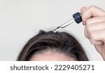 Small photo of woman applying serum oil on wet hair with pipette or using white comb to disentangle isolated.healthy strong hair,growth stimulation stop fall shiny.top of head forehead lateral view.after pregnancy