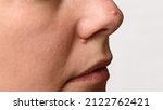Small photo of Closeup of two big moles or nevus on face. Nevi on nose of woman. Mole check and skin cancer prevention concept