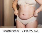 Small photo of Cropped image overweight fat woman stomach with obesity, excess fat in shape undercloth. Stomach flabs with friable skin, visceral fat. Arms pulling, hiding big excessive belly with navel. Close up