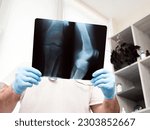 Small photo of Doctor in the clinic, traumatologist analyzes a broken leg. X-ray of the knee. Ultrasound. Injury of the leg in the knee joint. Osteoporosis
