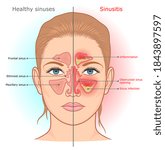 sinusitis infection and normal... | Shutterstock .eps vector #1843897597