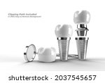 3d render Dental Implants surgery concept Pen Tool Created Clipping Path Included in JPEG Easy to Composite.