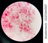 Small photo of Moderatre Gram neagtive bacilli on slide.