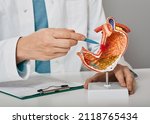 Gastroenterologist consultation, treatment of stomach diseases and ulcers. Doctor pointing to gastric ulcer on anatomical model of stomach